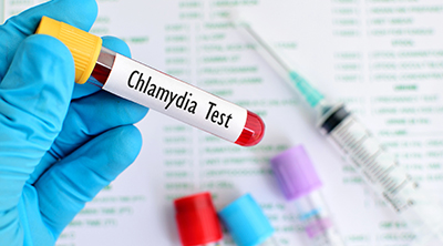 https://healthcarewriterdr.com/wp-content/uploads/2019/12/sexclamation-chlamydia-test.jpg